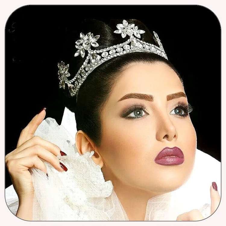 تاج تمام سنگ اصل و جذاب اروپایی(با خرید ۱۰ تا تاج از سایت ما یکی هم هدیه ببر ۱۰+۱=۱۱)